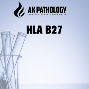 HLA B27