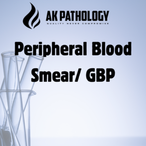 Peripheral Blood Smear/ GBP