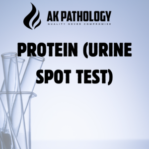 PROTEIN (URINE SPOT TEST)