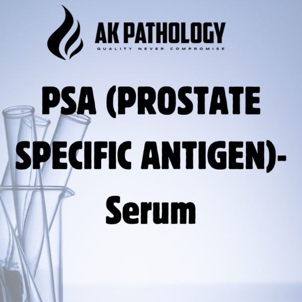 PSA (PROSTATE SPECIFIC ANTIGEN)-Serum