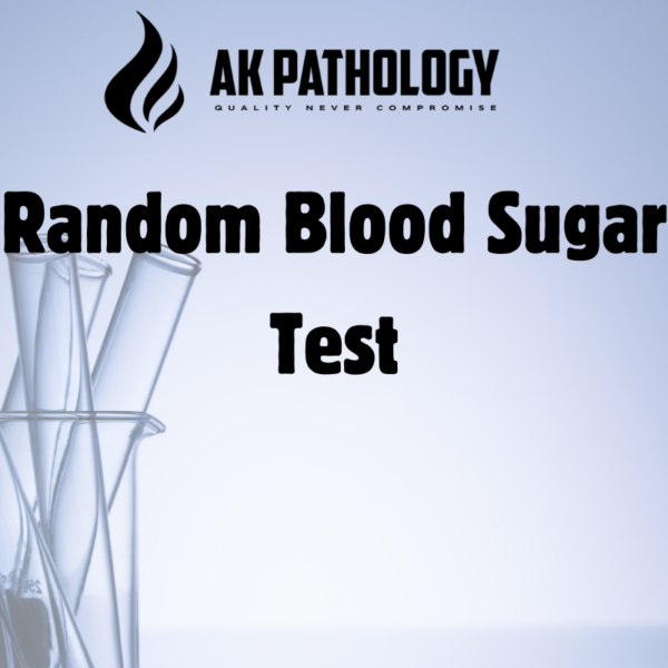 Random Blood Sugar Test