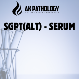 SGPT(ALT) - SERUM