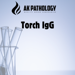 Torch IgG