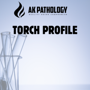 TORCH PROFILE