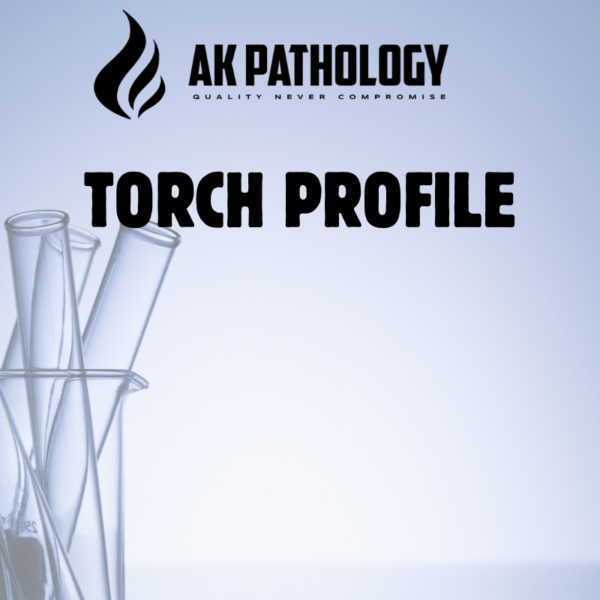 TORCH PROFILE