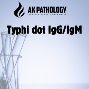 Typhi dot IgG/IgM