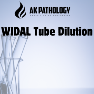 WIDAL Tube Dilution