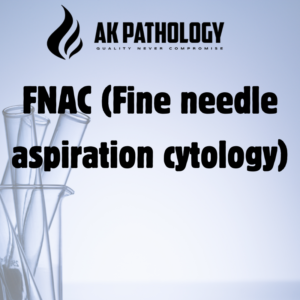 FNAC (Fine needle aspiration cytology)