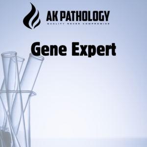 Gene Expert