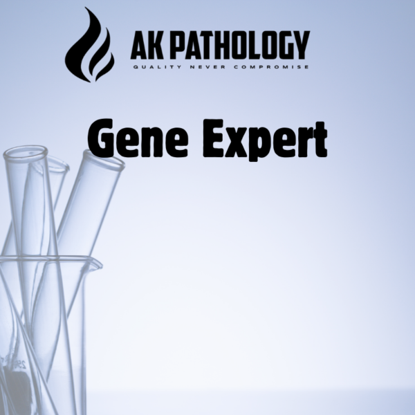 Gene Expert