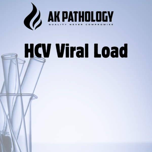 HCV Viral Load