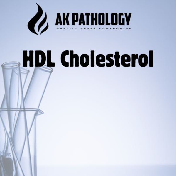 HDL Cholesterol