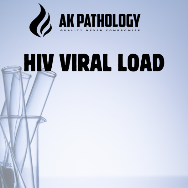 HIV VIRAL LOAD